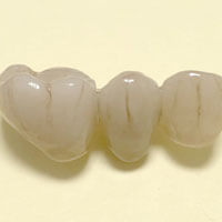 Ponte in zirconio ceramica