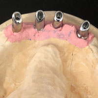 Telescopiche su impianti