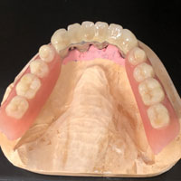 Telescopiche su impianti