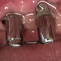 Telescopiche su impianti