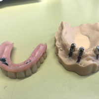 Telescopiche su impianti