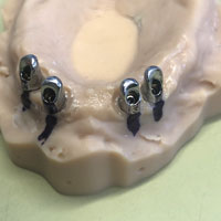 Telescopiche su impianti