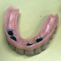 Telescopiche su impianti