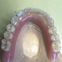 Telescopiche su impianti